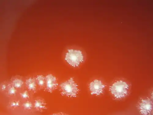 C.Tetani روی محیط بلاد آگار