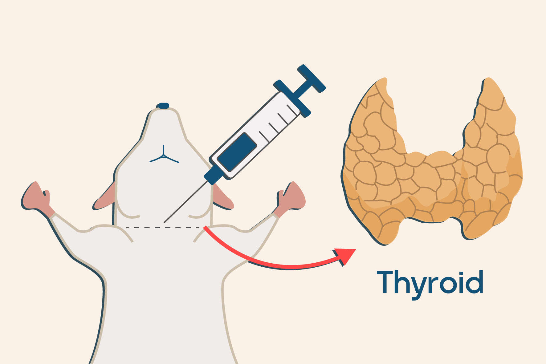 اختلالات تیروئید