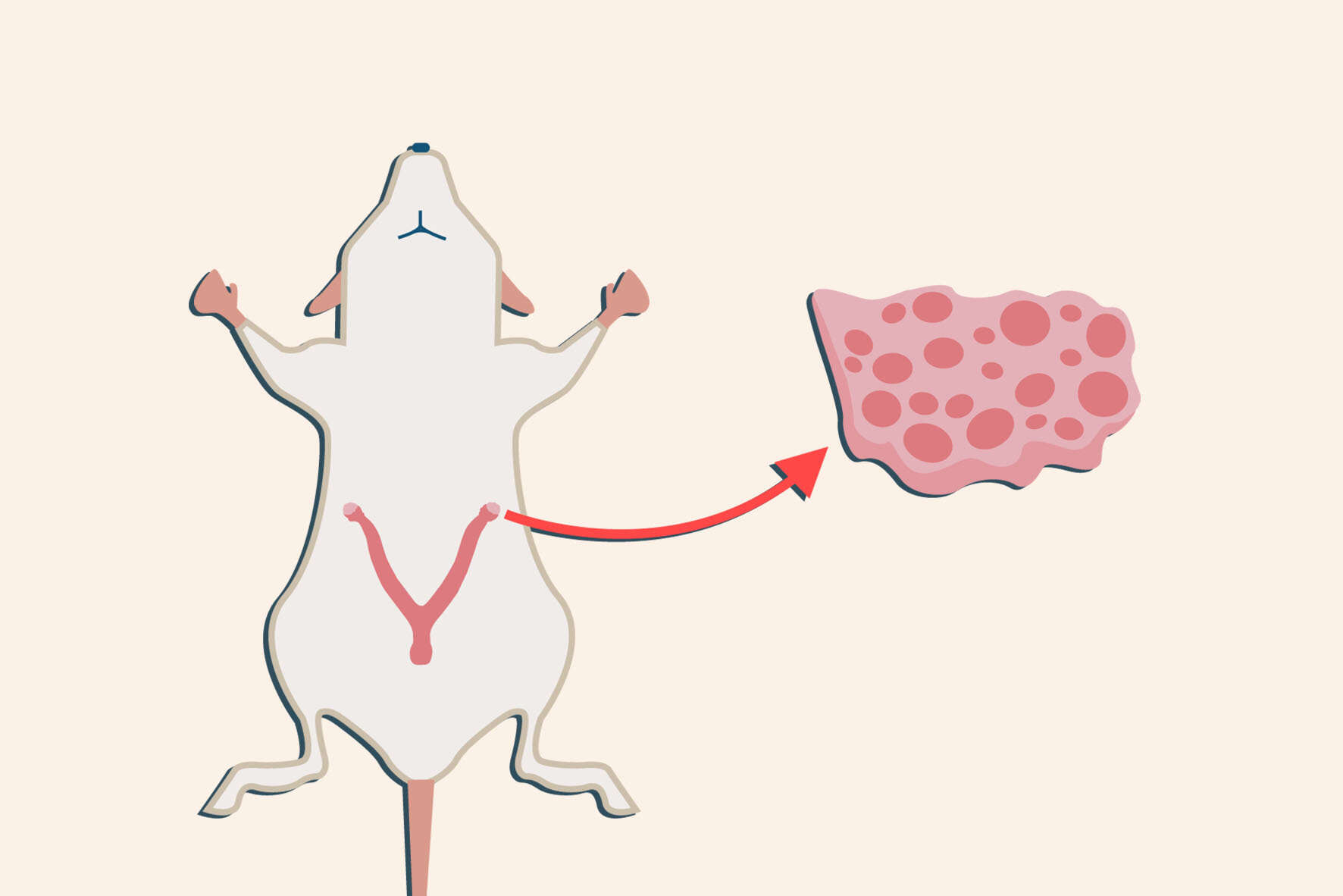 تخمدان-پلی-کیستیک