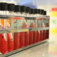 محیط کشت در میکروب شناسی به صورت مایع یا جامد به کار میروند که آن ها میتوان به صورت پلیت یا لوله ای تهیه کرد. محیط کشت لوله ای