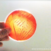 باکتری ها را می توان باتوجه به نیازشان بر روی محیط های کشت ساده یا مغذی رشد داد و یا از آن ها کلونی های ایزوله تهیه کرد پلیت کشت باکتری