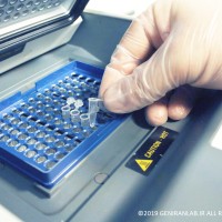 دستگاه ترمال سایکلر اصلی ترین ابزار مورد نیاز برای انجام تکنیک PCR است. دستگاه ترمال سایکلر