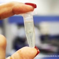 استخراج اسیدهای نوکلئیک اولین مرحله ای است که در شروع هر تکنیک مولکولی به آن نیاز داریم. استخراج اسیدهای نوکلئیک