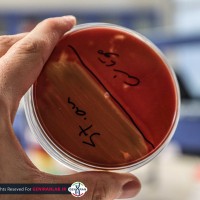 پلیت کشت باکتری