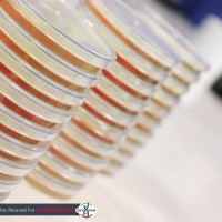 پلیت کشت باکتری